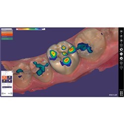 Exocad DentalCAD Virtual Articulator Flex