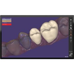 Exocad DentalCAD Provision Module Flex
