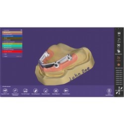 Exocad DentalCAD Bar Module Perpetual